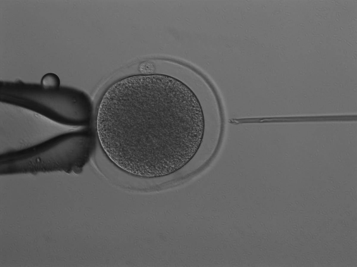 First Successful IVF Kangaroo Embryo Pushes Marsupial Conservation Forward