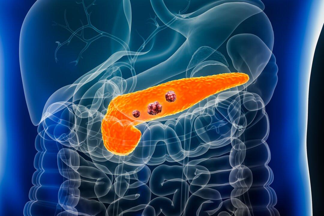 Pancreatic Cancer: The Overlooked Warning Signs, Hidden Risks, and Prevention Strategies