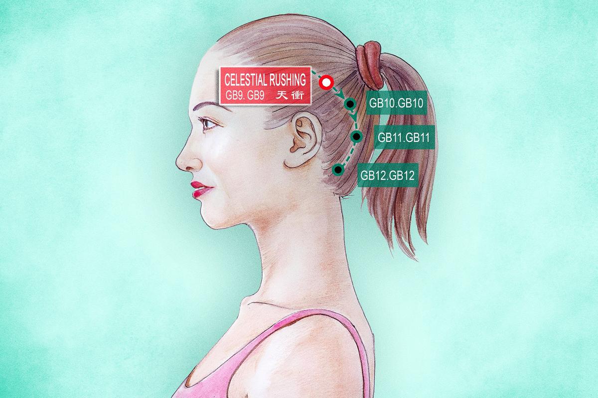 Wisdom Teeth, Sore Gums, and an Acupoint to Treat Them