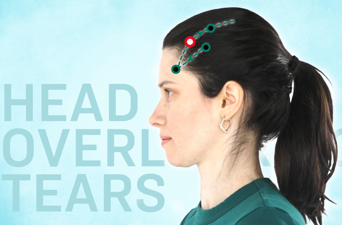 Tou Lin Qi—An Essential Acupoint to Relieve Tired, Dry Eyes