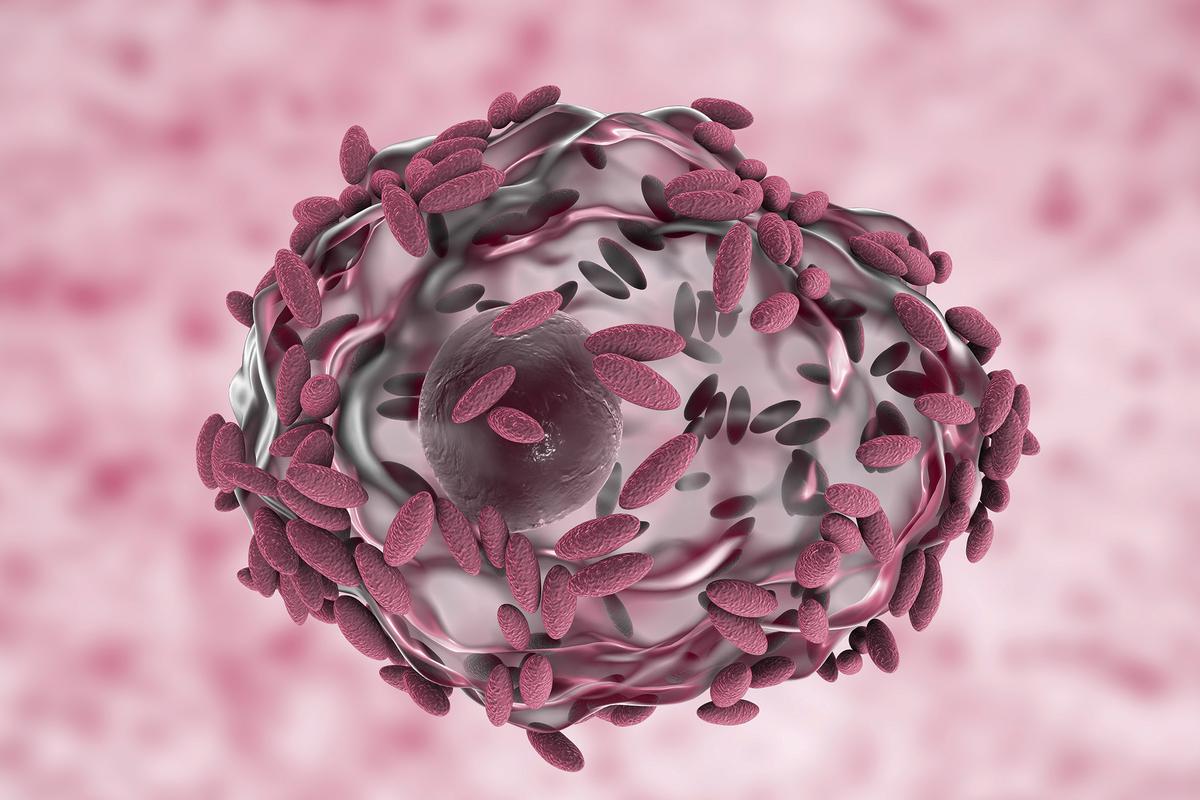 Bacterial Vaginosis, Affecting 1 in 3 Women, May Be an STI