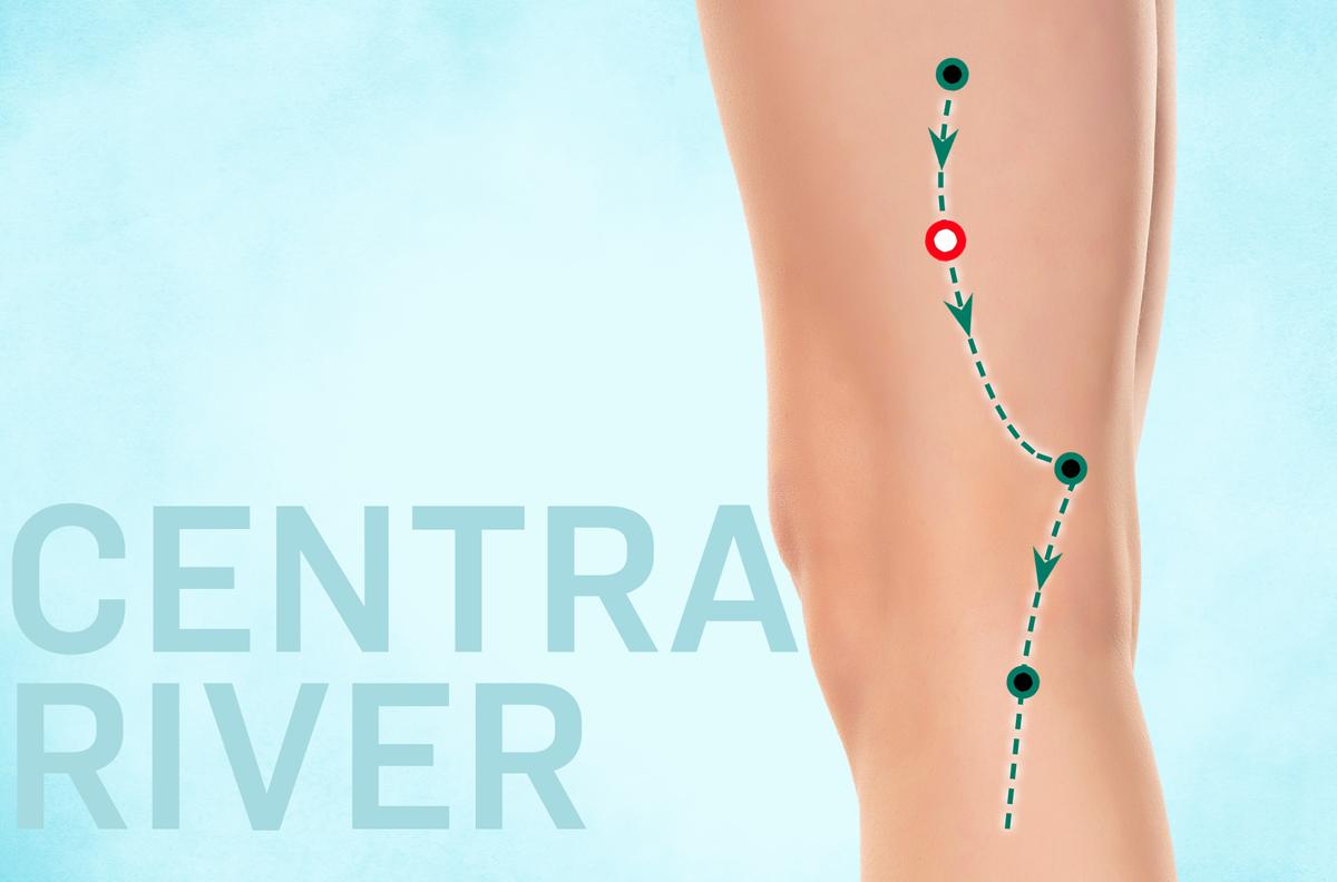 Zhong Du: Let’s Clear Up Confusion and Energize the Gallbladder Meridian