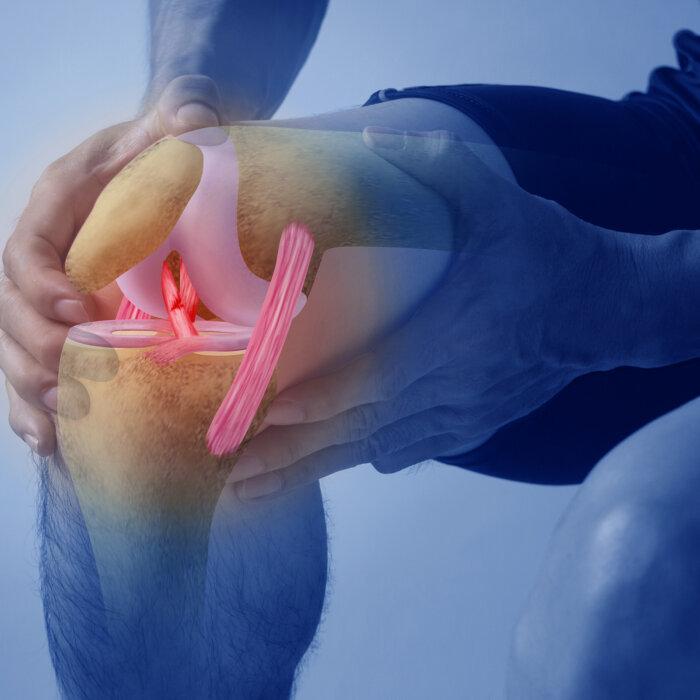 Common Knee Surgery Linked to Arthritis: Study