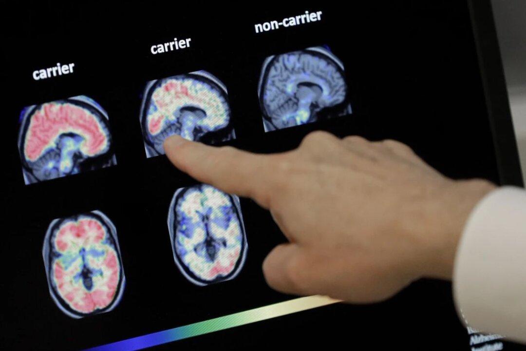 Shingles Vaccine Could Reduce Risk of Dementia, Study Suggests