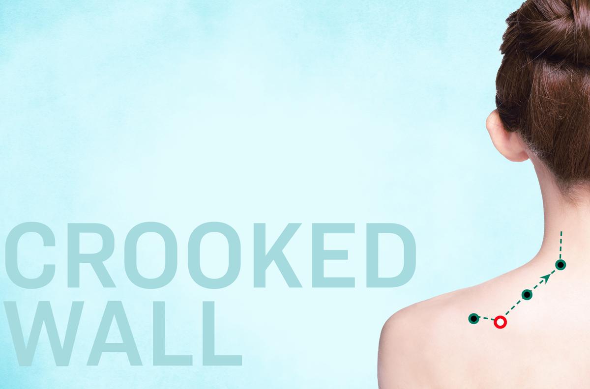 Engage Your Shoulder’s Quiet Maintenance Crew With This Acupoint