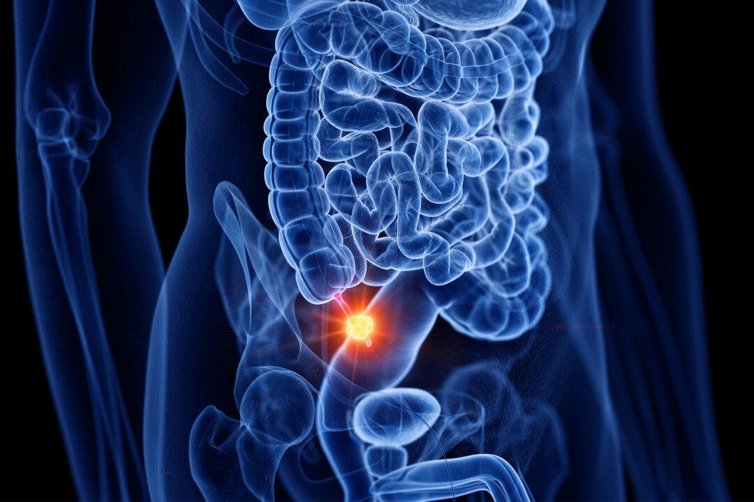 Appendix Cancer Rates Quadruple Among Older Millennials, Signs Often Missed