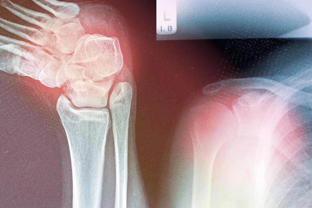 Why Musculoskeletal Diseases Are Rising—and How to Address the Root Causes