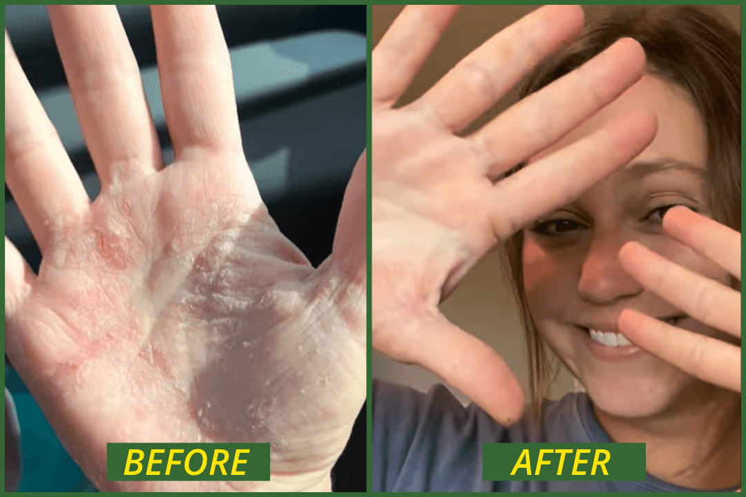 From Big Pharma’s Grip to Holding Her Child’s Hands Again