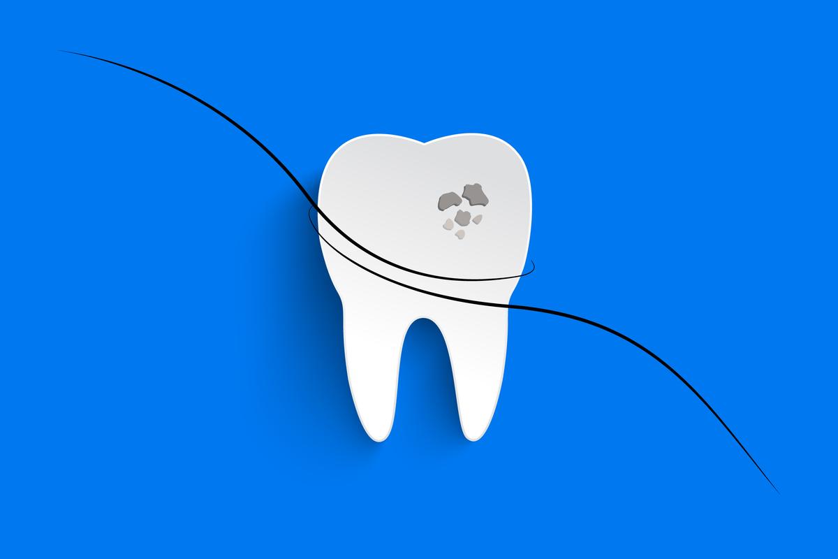 Hair Protein May Be Used for Dental Fillings