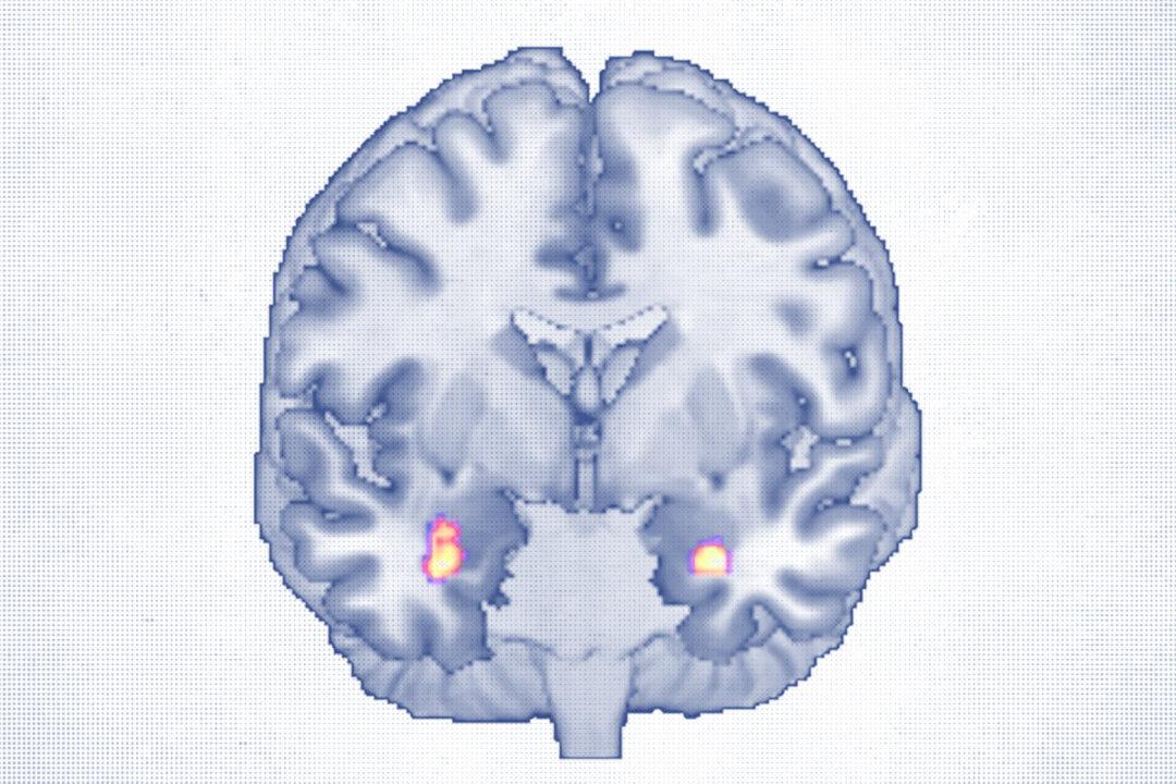 Cognitive Behavioral Therapy Reshapes Brain Structure