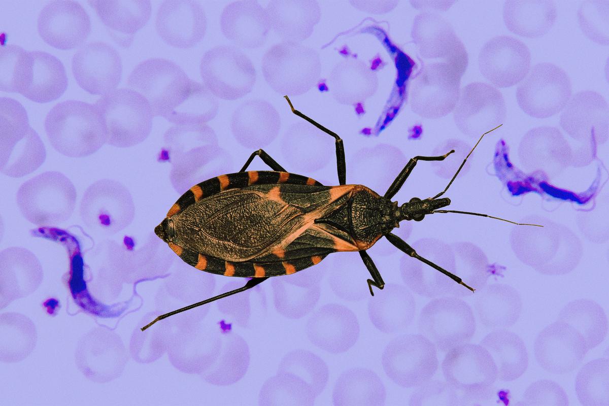 All You Need to Know About Chagas, the ‘Kissing Bug’ Disease Recently Labeled Endemic