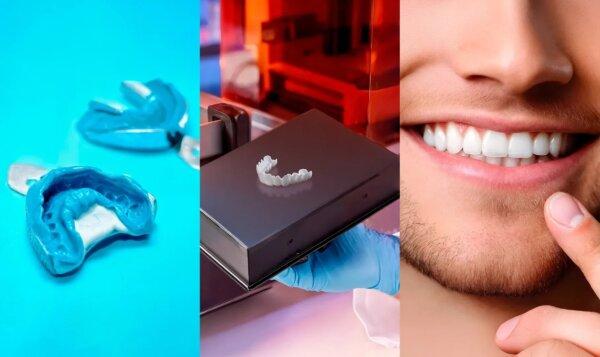 Shiny Smile Veneers