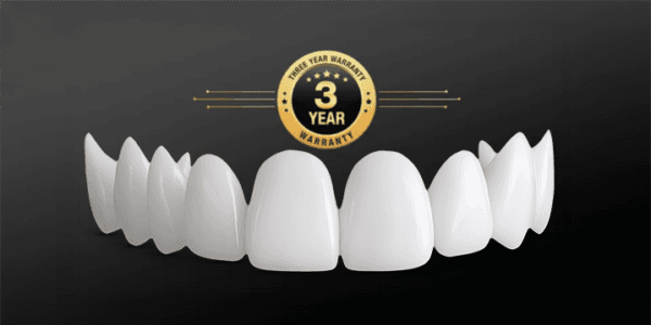 Shiny Smile Veneers