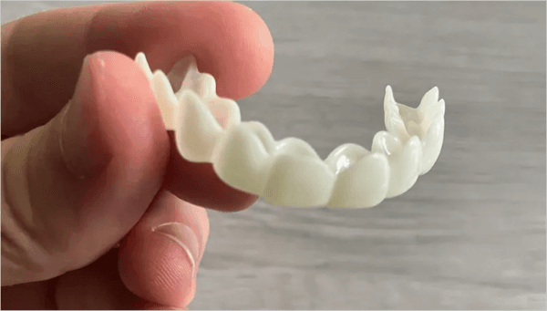 Shiny Smile Veneers