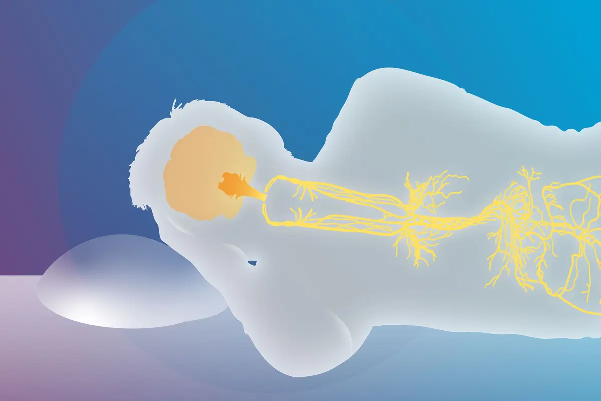 Activating Vagus Nerve Relieves Insomnia—How to Do It
