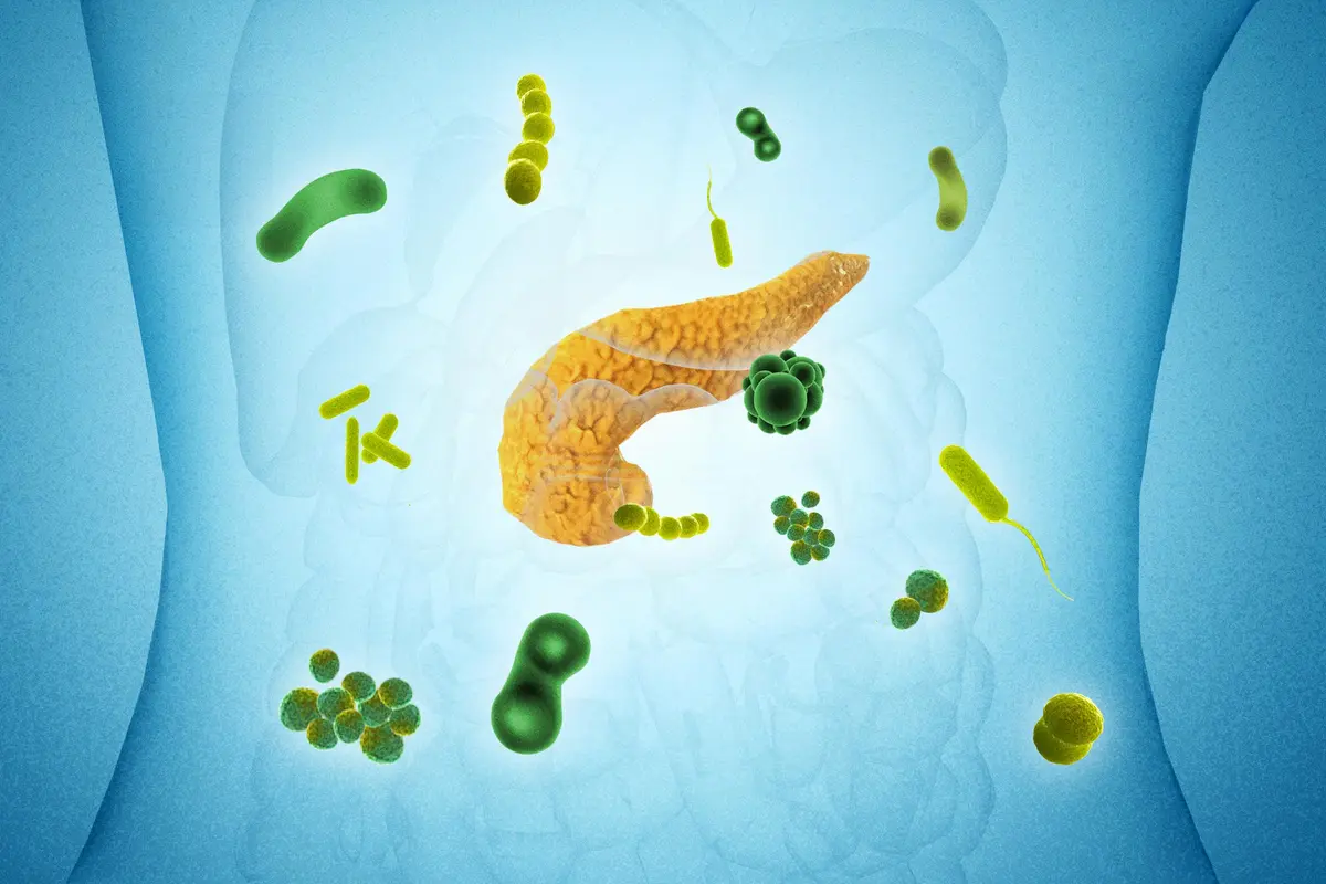 27 Microbes Linked to Pancreatic Cancer, Major Study Finds thumbnail