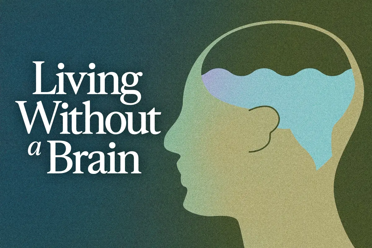 The Man Who Lived Without a Brain thumbnail