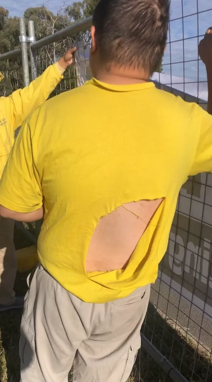 Zhuxing Cao, a practitioner from Sydney, had his shirt ripped by CCP supporters near Hyatt Hotel Canberra on Nov. 24, 2025. (Supplied)