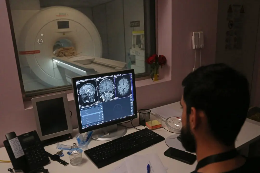 Brains Have 5 ‘Major Epochs’ in a Lifetime: Study