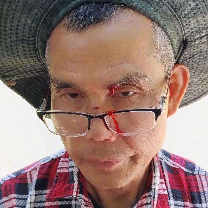 Assault Leaves Falun Gong Practitioner Bloodied, Days After Bomb Threat