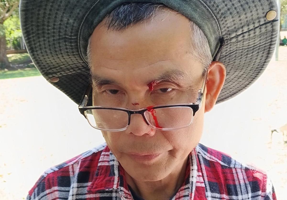 Assault Leaves Falun Gong Practitioner Bloodied, Days After Bomb Threat