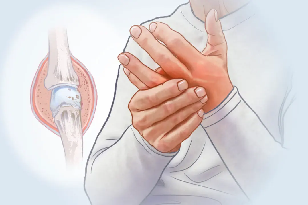 Rheumatoid Arthritis: When the Immune System Attacks Your Joints–Symptoms to Watch For