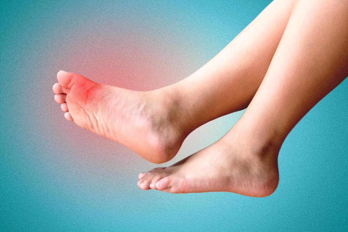 Wake up to Gout Pain? Natural Solutions for Relief and Uric Acid Balance thumbnail