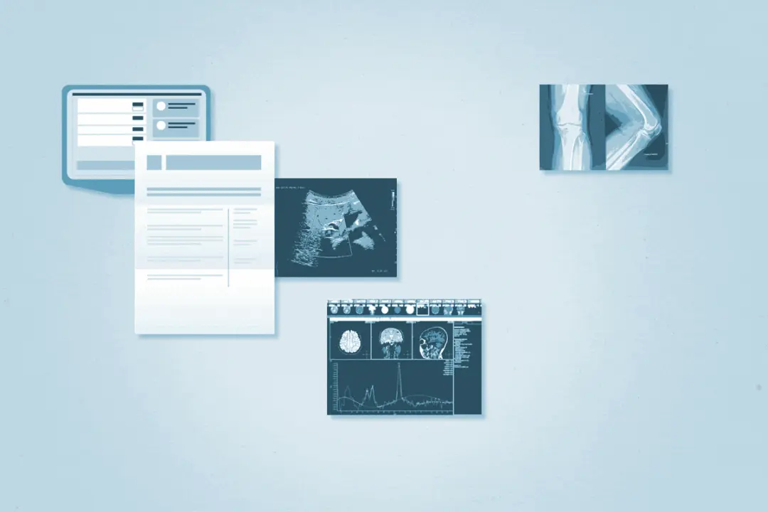 Why a ‘Medical Second Brain’ is Key To Your Health Care