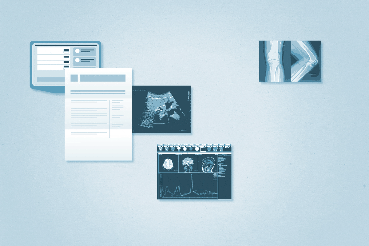 How a Medical Second Brain is Key To Your Treatment