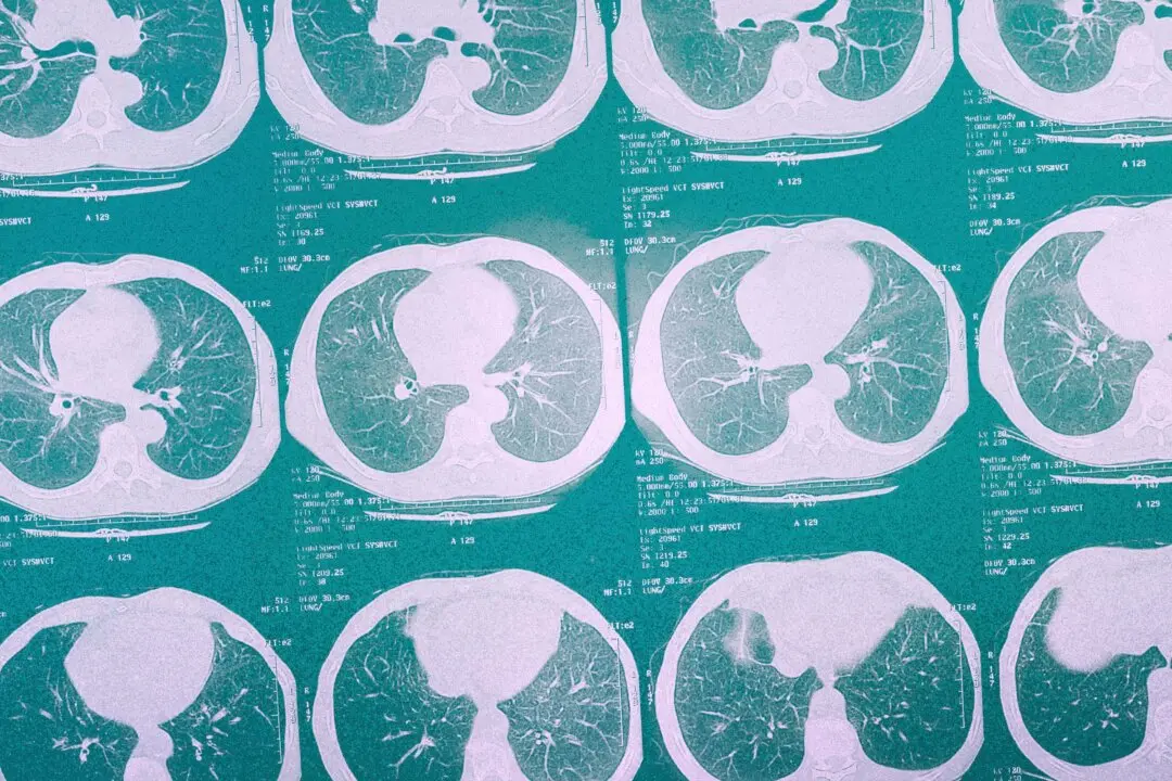 This Aggressive Lung Cancer Often Hides Until It’s Too Late
