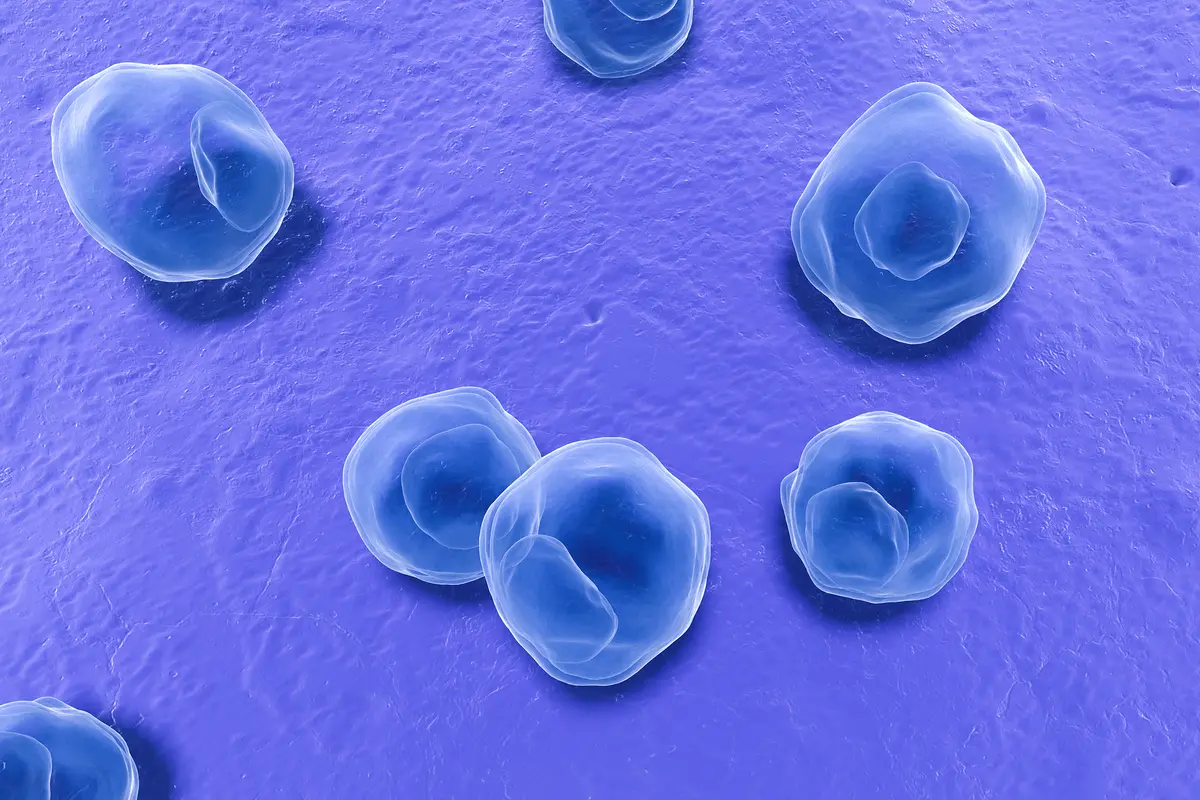 Common Bacteria Linked to Alzheimer’s Disease