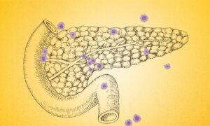 7 Overlooked Warning Signs of Pancreatic Cancer