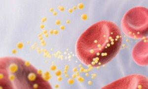 Is High Cholesterol Really Bad for You? It Depends