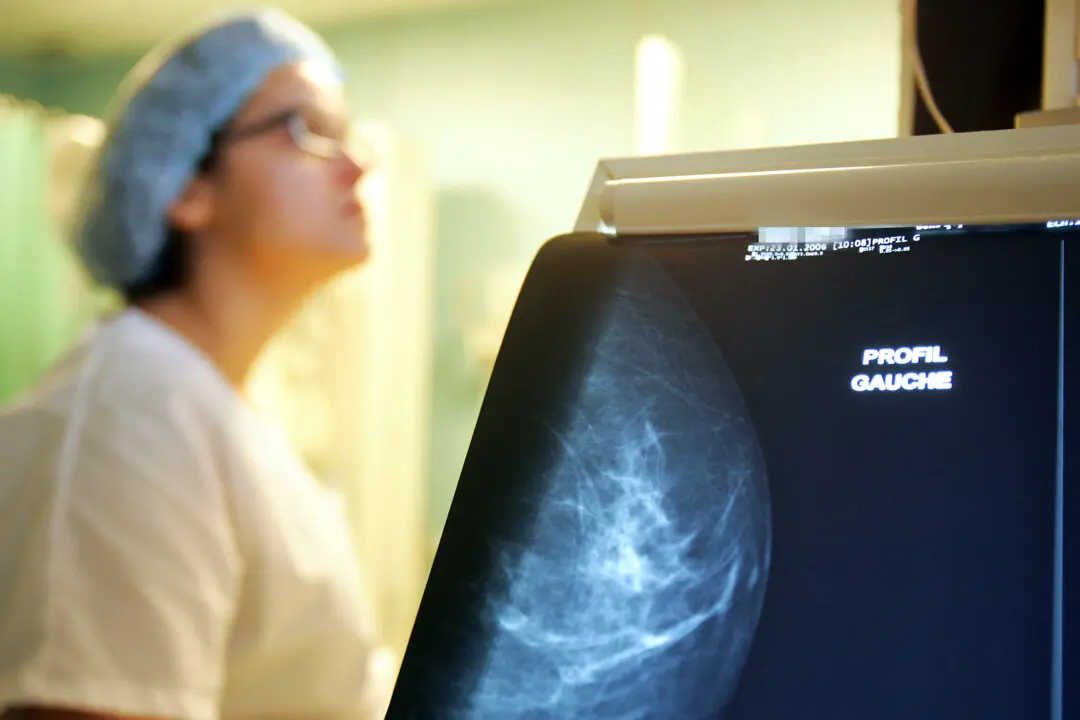 Doctor Group Updates Guidance on Breast Cancer Screening