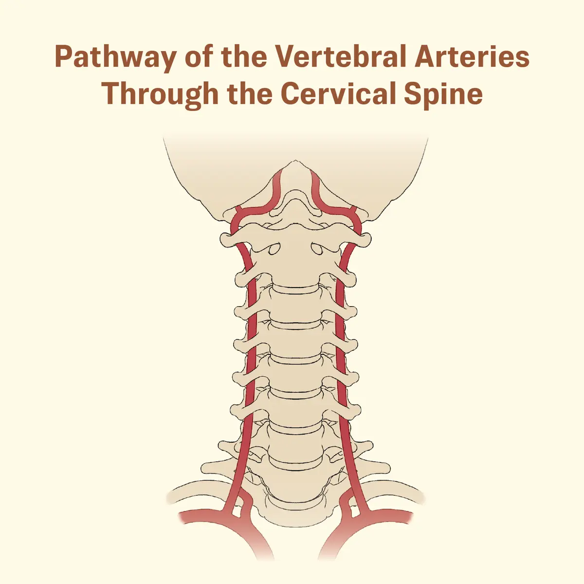 Pathway of the vertebral arteries through the cervical spine. (The Epoch Times)