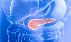 New Drug Extends Survival for Patients With Pancreatic Cancer