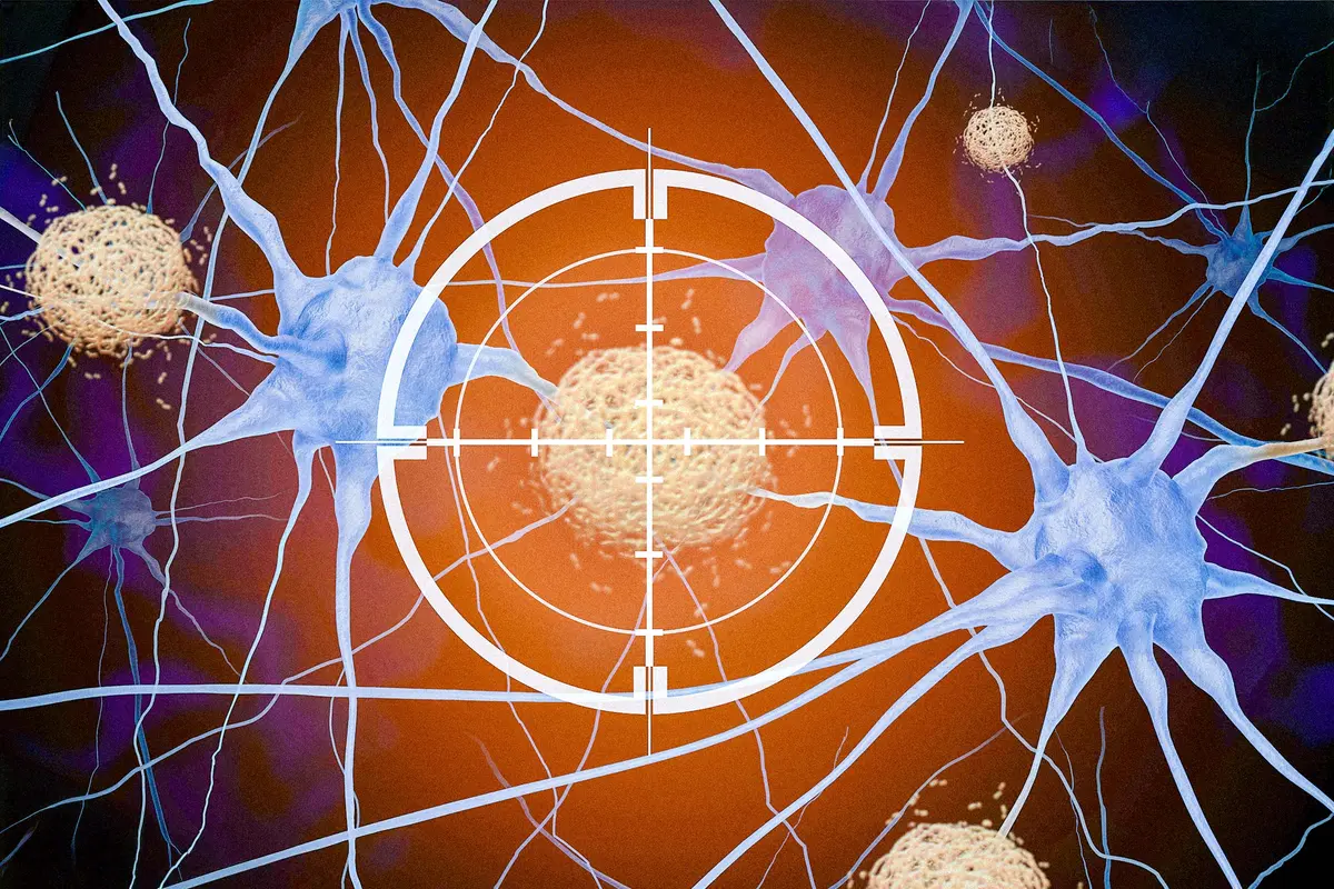 Major Review Casts Doubt on a Generation of Alzheimer’s Drugs