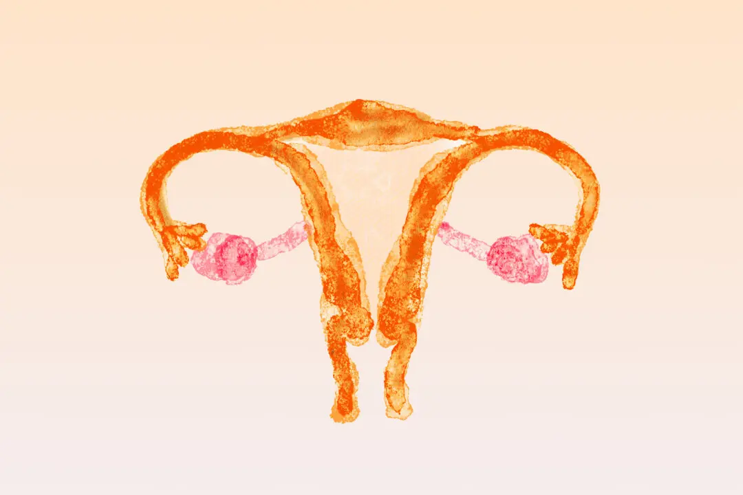 PCOS Was Never a Cystic Disease–It’s a Metabolic Syndrome