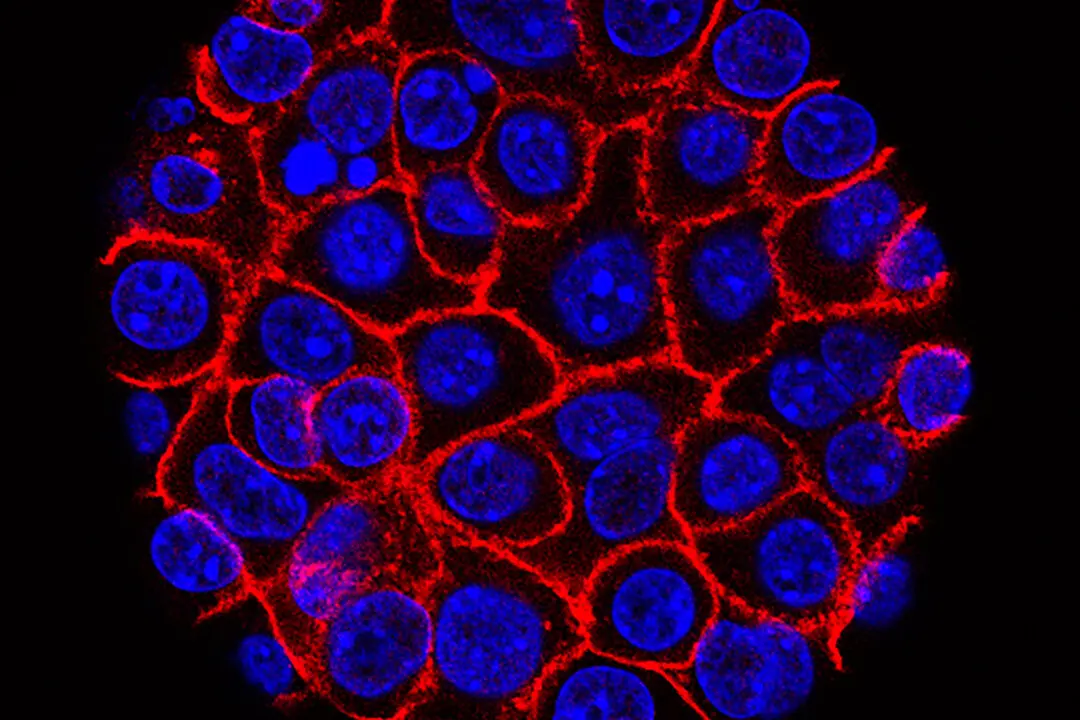 Drug Reduces Risk of Prostate Cancer Spread and Death in Late-Stage Study