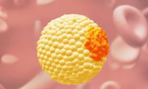 Why ApoB May Be a Better Test Than Cholesterol