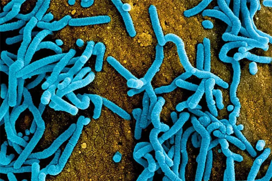 Uganda Detects Severe Disease Amid Ebola Outbreak: WHO