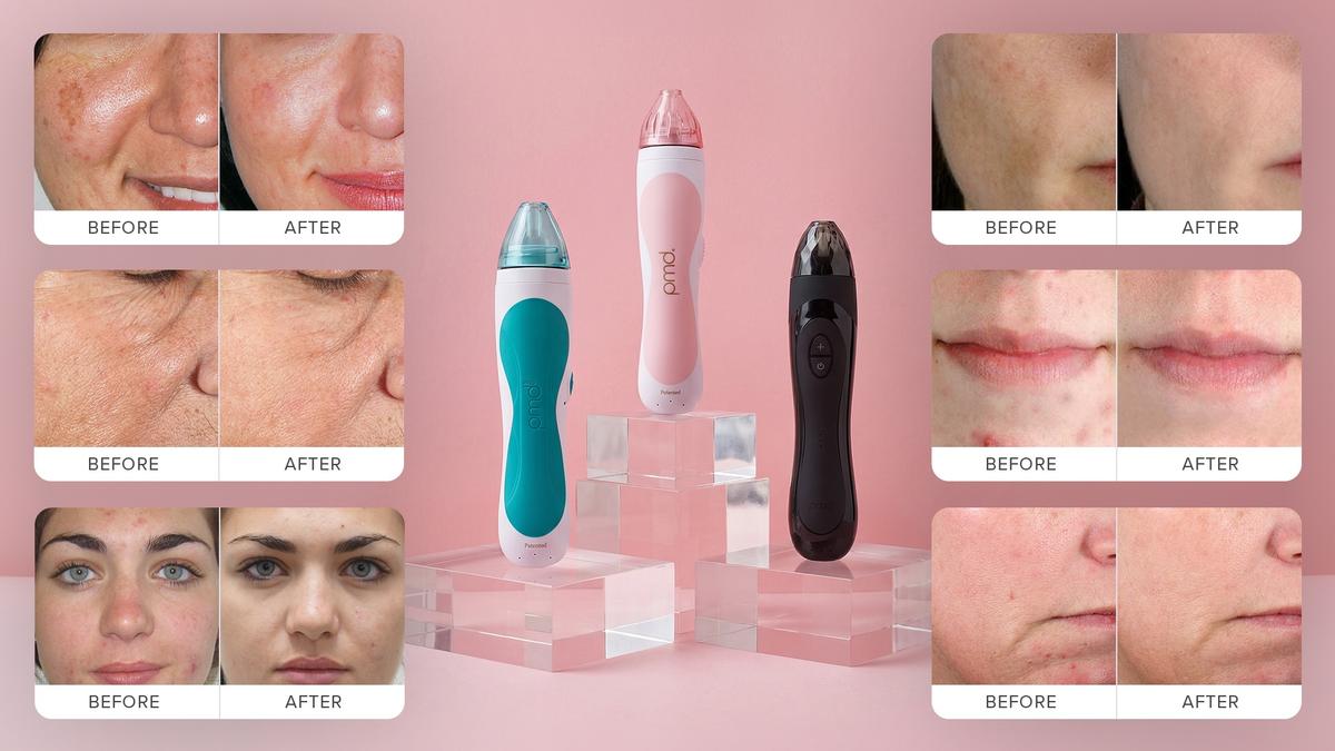 PMD Personal Microderm triggers cell regeneration, promotes natural collagen production, and reveals a fresher, brighter complexion for anyone.