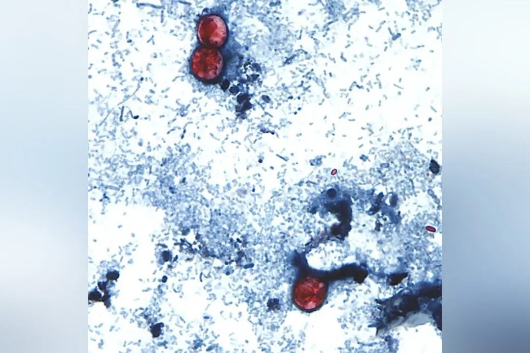 Diarrhea-Causing Parasite Infecting More Than 1,200 in Michigan Has Not Spread to Canada: PHAC