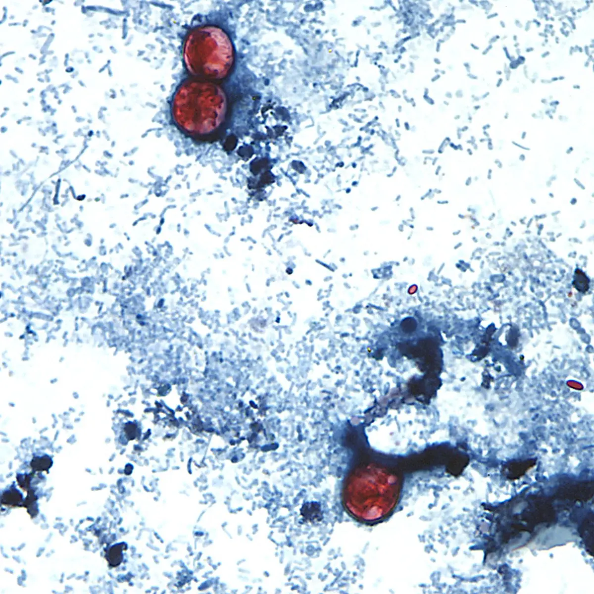This undated photo taken through a microscope shows Cyclospora cayetanensis oocysts found in a fresh stool sample that had been prepared with a formalin solution and stained with safranin. (CDC via AP)
