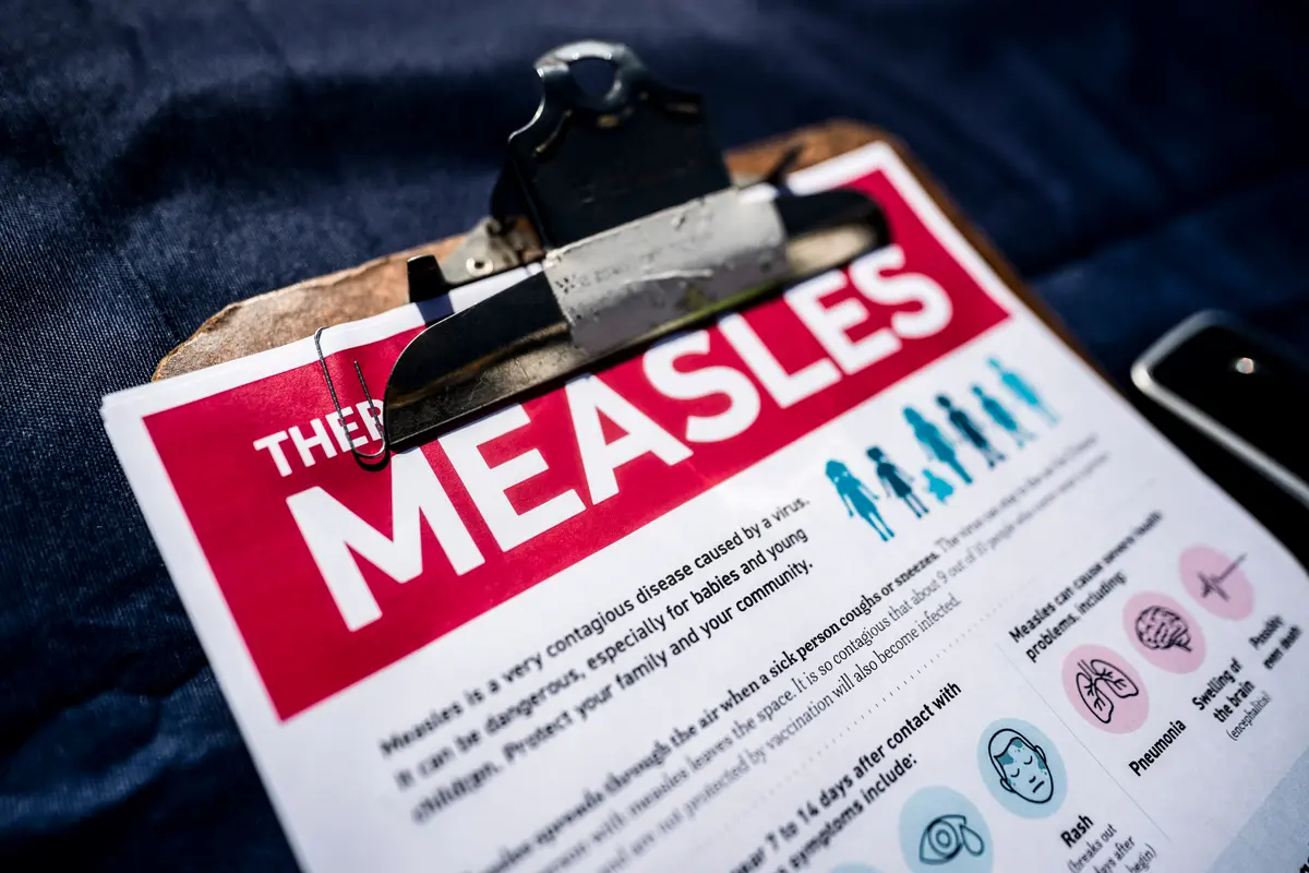 US Measles Cases in 2026 Highest in 35 Years