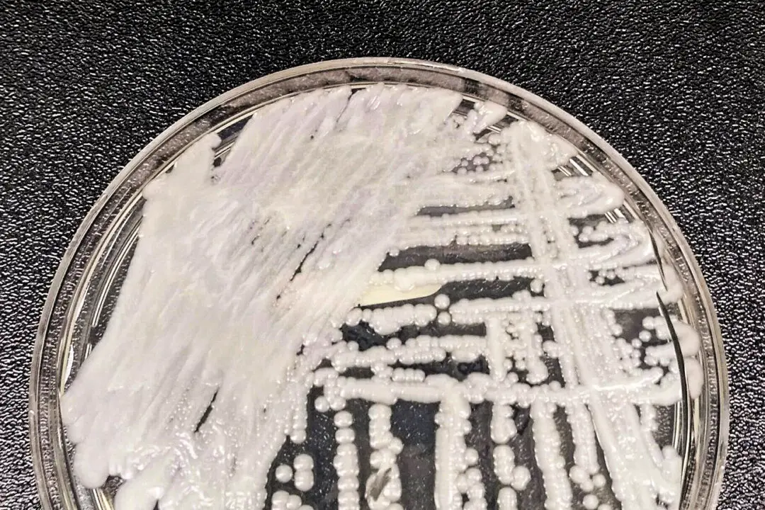 Cases of Potentially Deadly Fungus Detected in 27 States So Far This Year, CDC Says