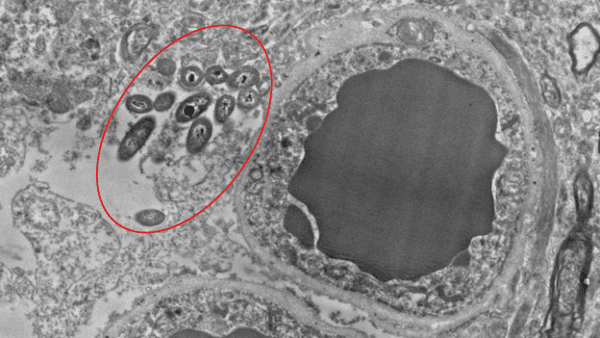 A Scanning Electron Microscope image of a human brain slice showing bacteria (circled in red) next to a blood vessel. Adapted from a writeup in Science Magazine.