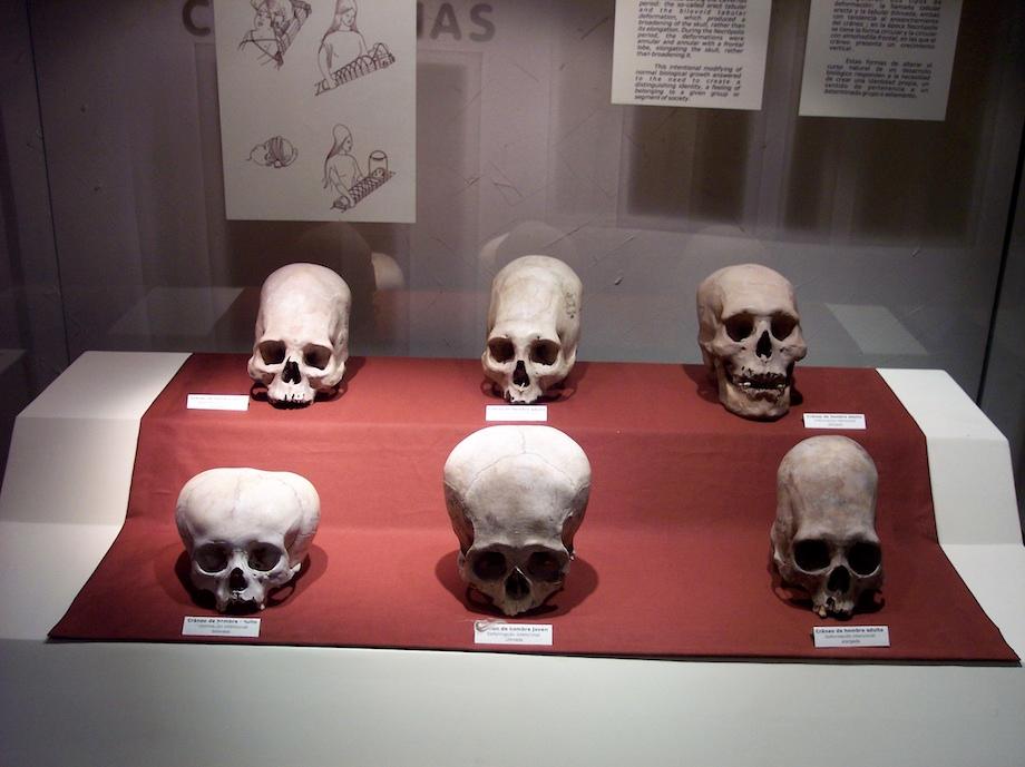 A case of skulls from the Andean Paracas culture, as seen in the National Museum of the Archaeology, Anthropology, and History of Peru. (CCBY-SA)