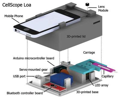 The device includes a 3-D-printed case housing simple optics, circuitry, and controllers to help process the sample of blood. ( Mike D'Ambrosio and Matt Bakalar, Fletcher Lab, UC Berkeley)