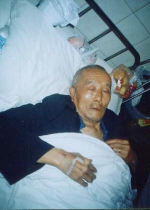 The injured 80-year-old farmer (The Epoch Times)